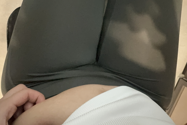  위고비 식욕억제제 주사 단계 부작용 처방 후기
