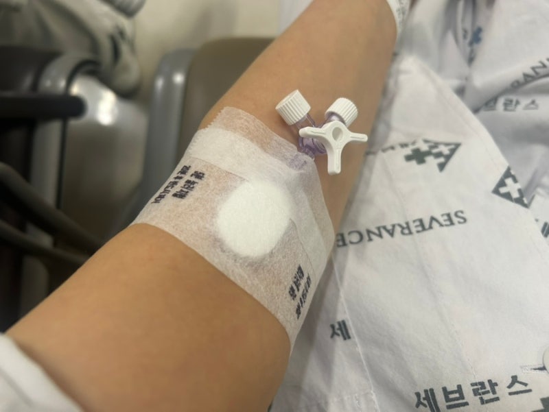 뇌종양후기6｜뇌수막종 수술 후 3번째 MRI 검사