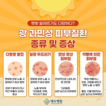여름철 야외활동 피부 질환 광과민성 햇빛 알레르기