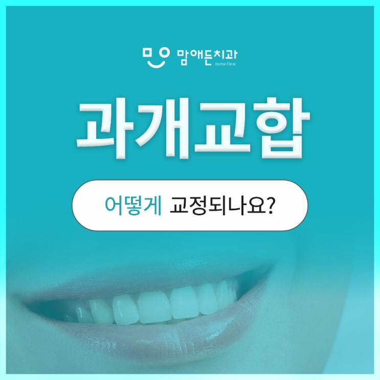  과개교합 교정 시 얼굴형 변화 기대 효과