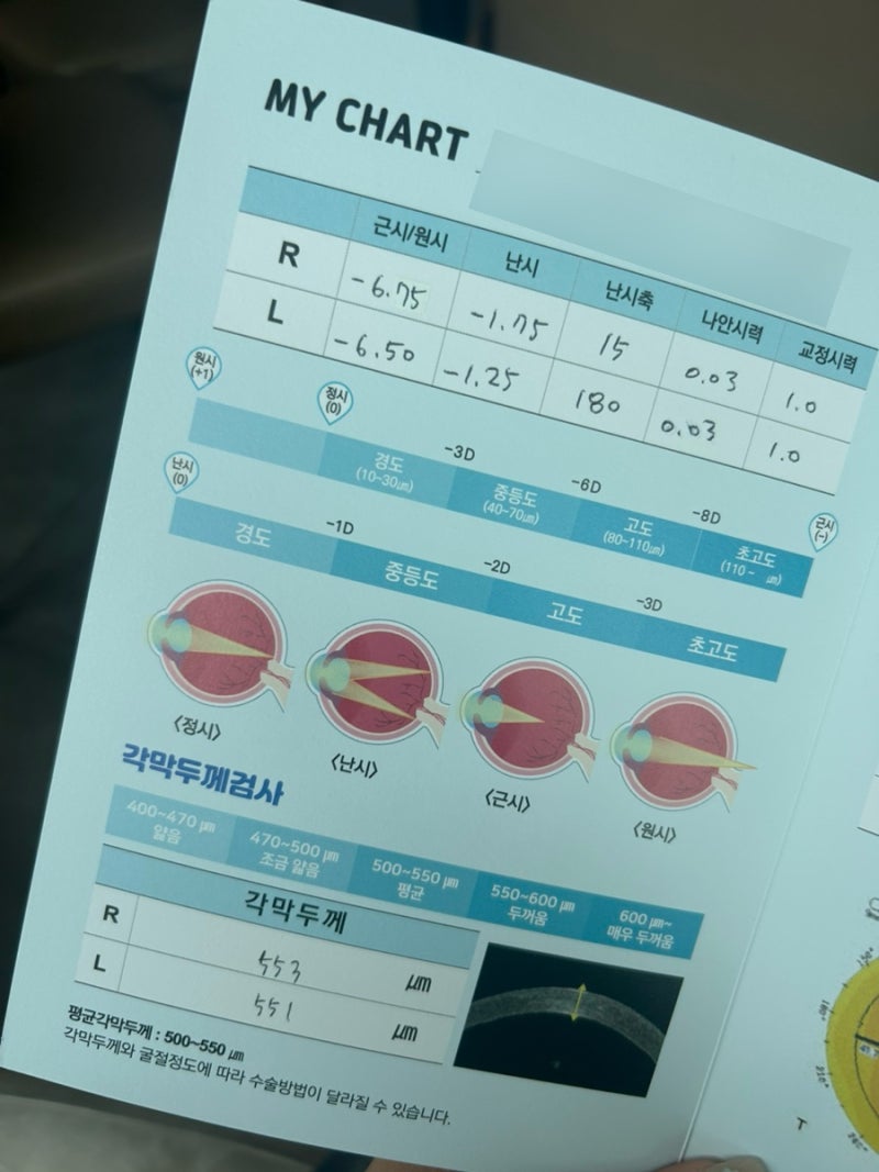 대전 효안과 | 스마트스마일라식 | 혼자 가서 수술 후기