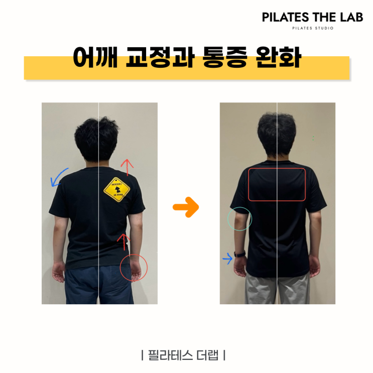  목동 필라테스 어깨 비대칭 교정, 필라테스만으로 달라진 남성 회원 후기