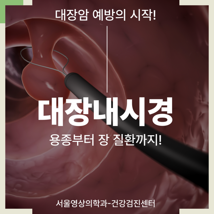  경기광주대장검사, 예방의 시작 용종부터 장 질환까지