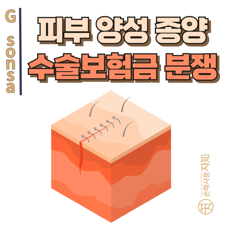  피부양성종양 수술비 거절, 수술분류표의 숨은 비밀 - [조정례, BoDa]
