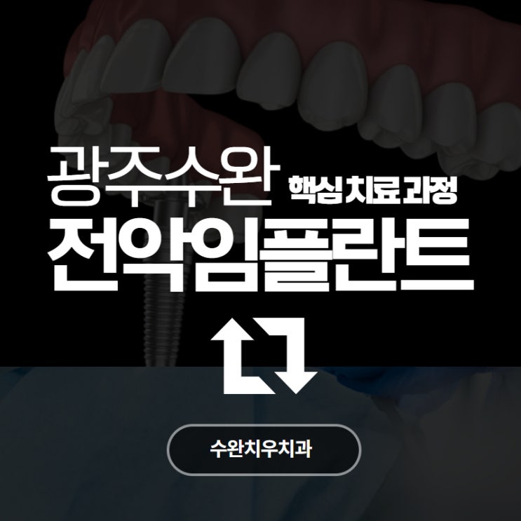  전악임플란트, 수완지구치과에서는 어떻게