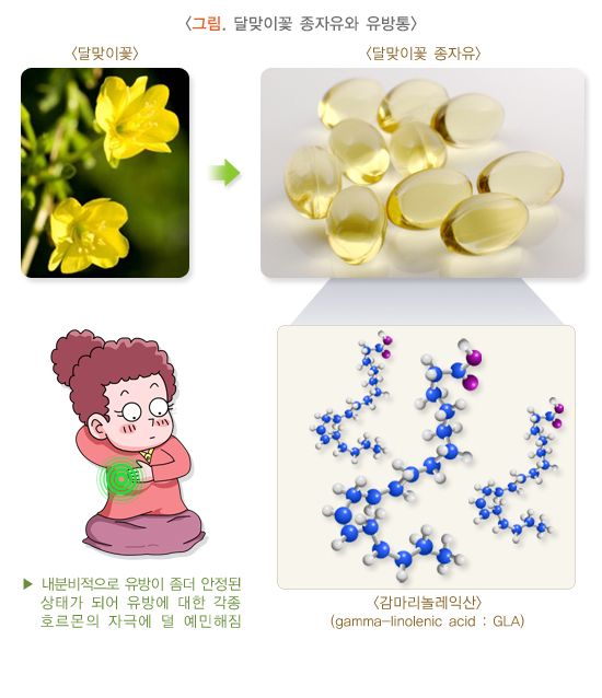 유방통(유방 통증)