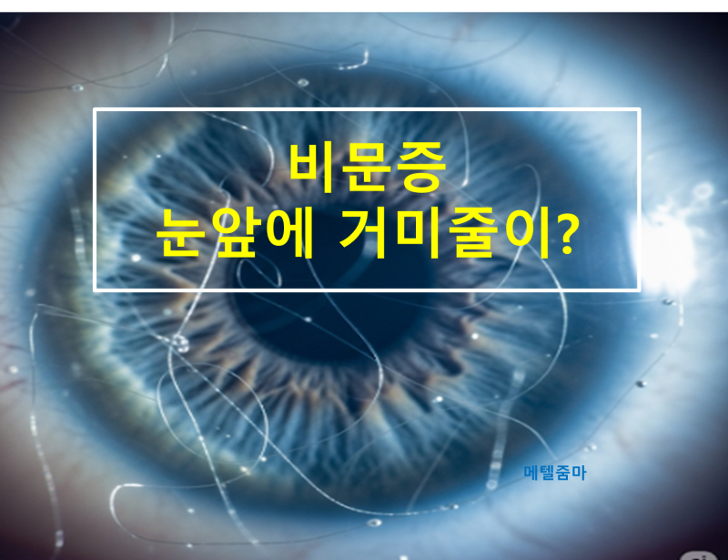 눈앞을 떠다니는 그림자, 혹시 '비문증'일까요?