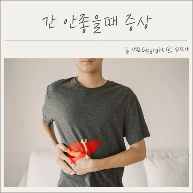  간 안좋을때 증상 황달 원인 간수치 낮추는법