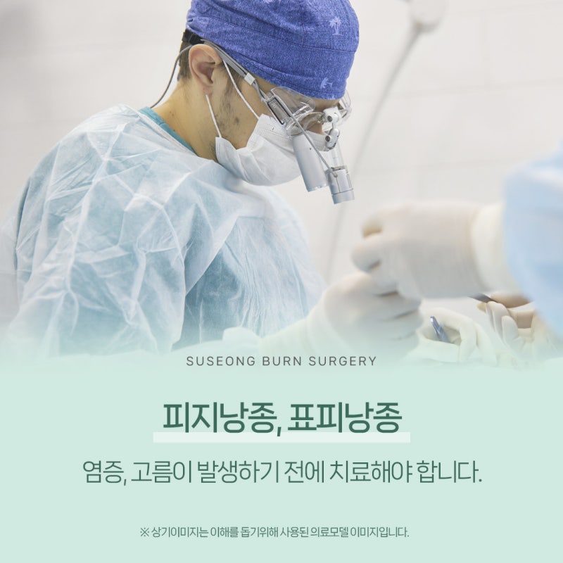 경주 포항 피지 낭종은 크기가 더 커지기 전에 빠른 치료가 중요합니다!