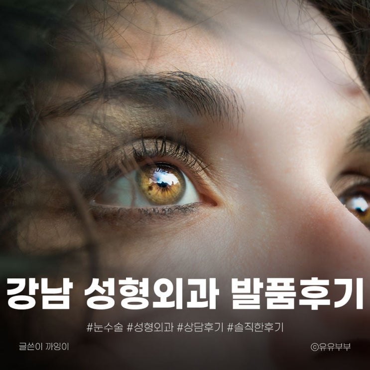  쌍커풀 수술 직접 발품한 강남 성형외과 4곳 비교 상담 완전 분석 (feat.찐솔직리뷰)
