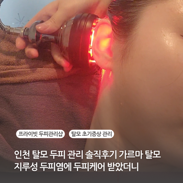 닥터모락 인천탈모 두피관리 솔직후기 가르마탈모 지루성두피염에 두피케어 받았더니