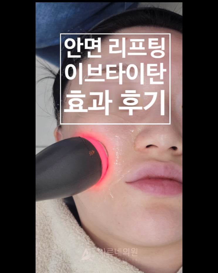  이브타이탄 중안부리프팅 후기 가격 효과 공식인증병원 아르네의원