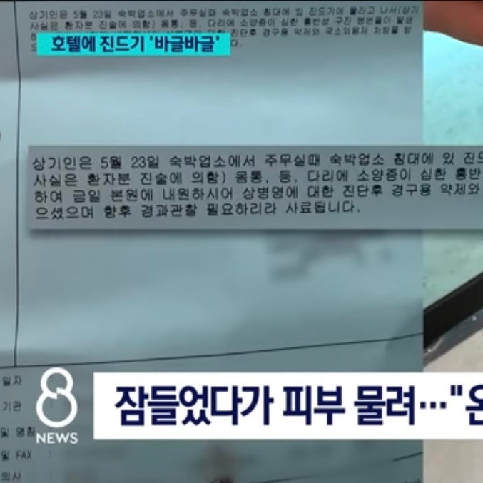  대구 이월드 놀이공원 근처 호텔 진드기 사건 정보, 보상, 과태료 금액, 현재 진행 상황