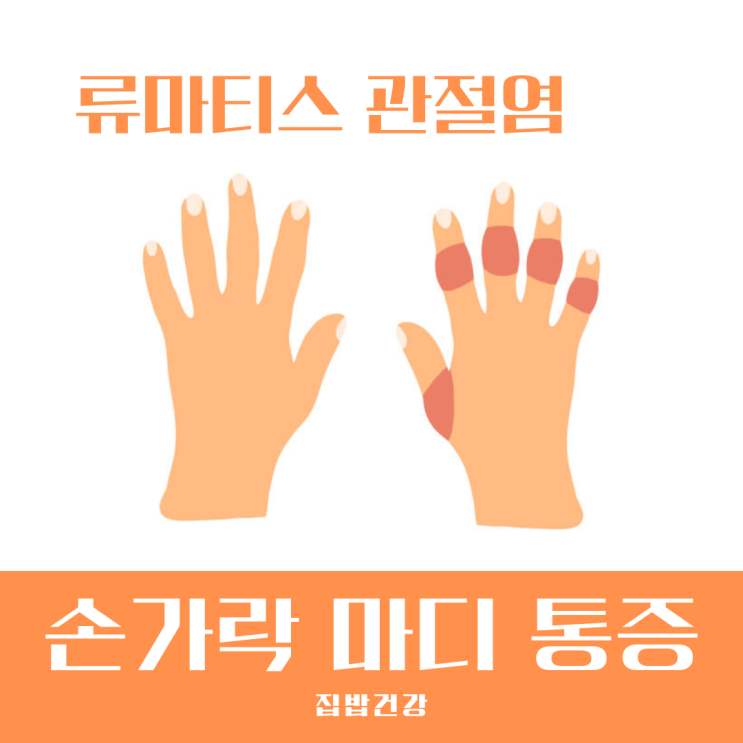 손가락 중간 마디 통증 류마티스 관절염의 결정적인 초기 신호