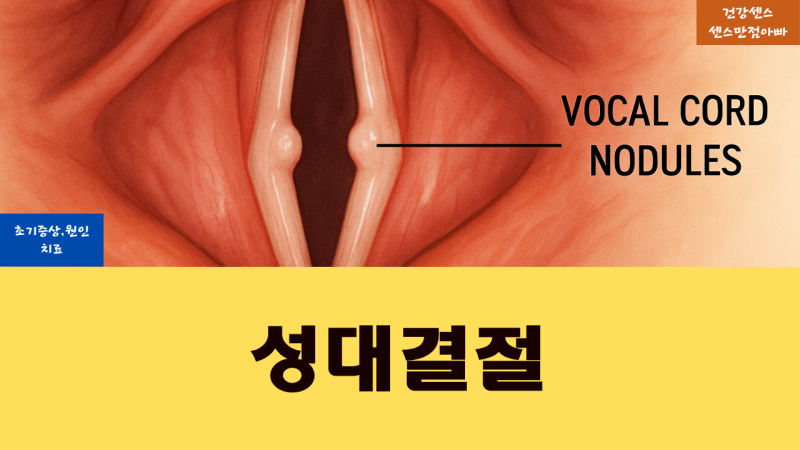 성대결절 초기증상 원인 및 치료