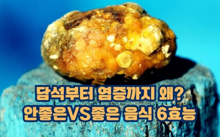  담석부터 염증까지 왜? 안좋은 VS 좋은 음식 6효능