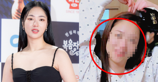  배우 전여빈, 의료진에게 경고 받았다? 발작 일으켜 실신 직전까지 간 충격적인 당시 상황 (+나이, 인스타, 드라마, 키)