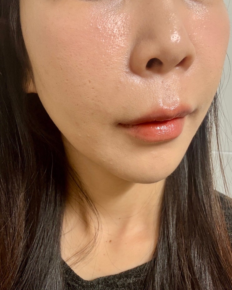  신사역 엘라비에 리투오 콜라겐 스킨부스터 물광피부 일주일차 후기