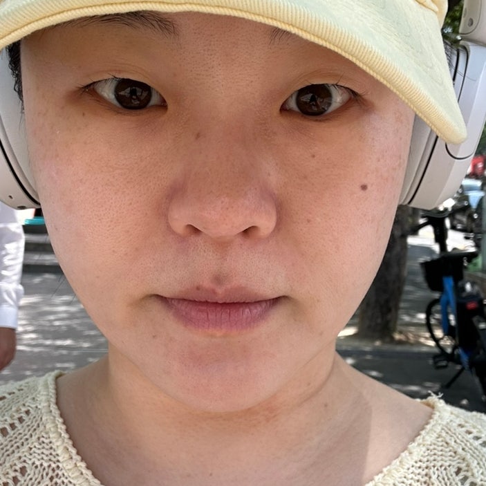 아쿠아필 신논현역피부과에서 깔끔하고 맑은 피부 만들기, 통증 효과 가격, 부작용