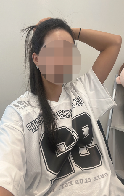 대구 서구 헤어라인 교정, 6년차 전문가가 알려드리는 방법