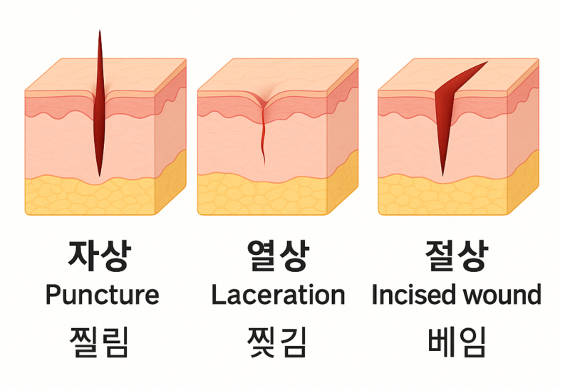 자상 열상 뜻 치료 방법 알려드립니다