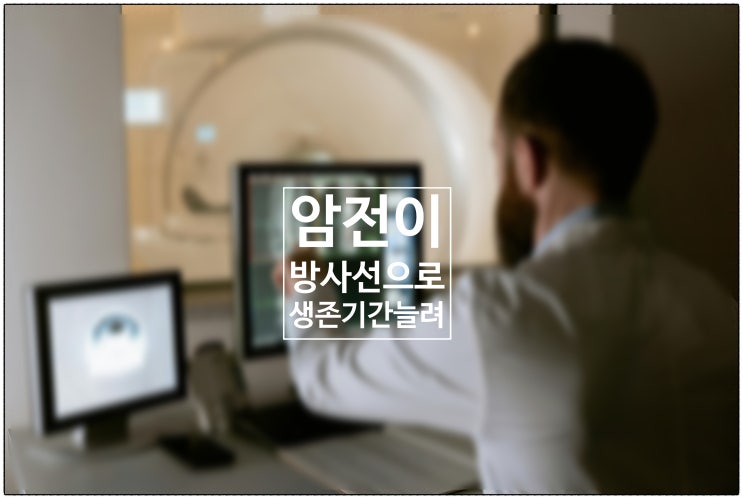  '암 전이되면 끝'은 옛말....3~5곳 전이, 방사선 집중 쏘여 생존기간 크게 늘린다.
