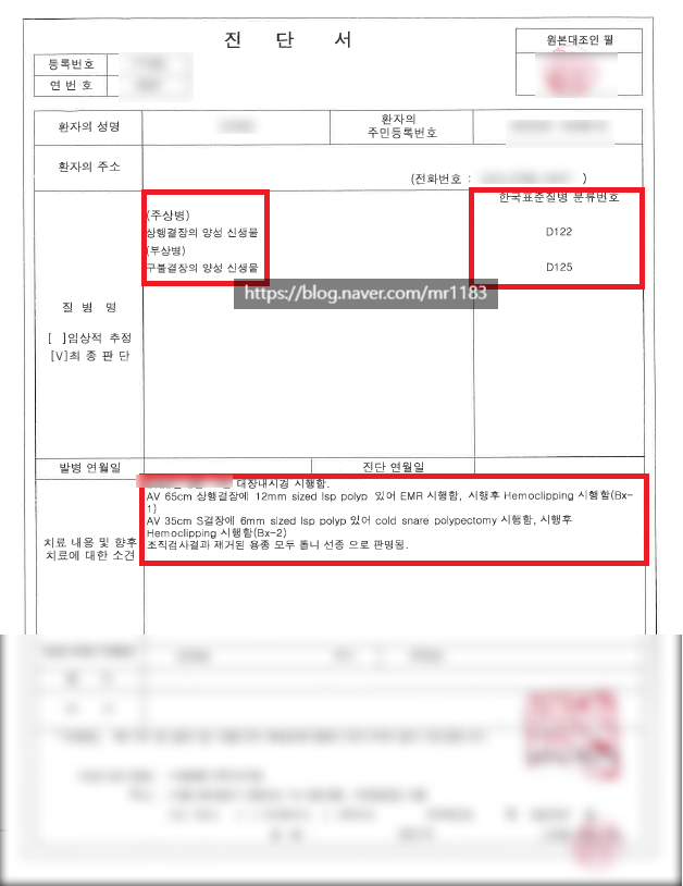 결장의 양성신생물 D122, D125 제자리암(소액암) 진단비 가능
