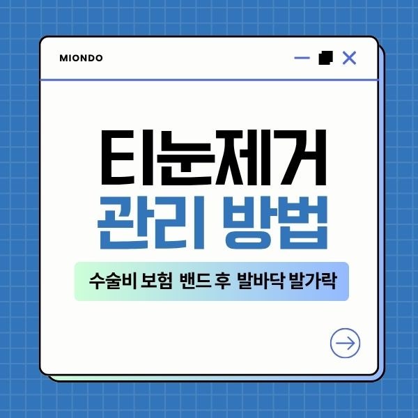 티눈제거 가격 수술비 보험 청구 밴드 후 관리 방법 고통 발바닥 발가락