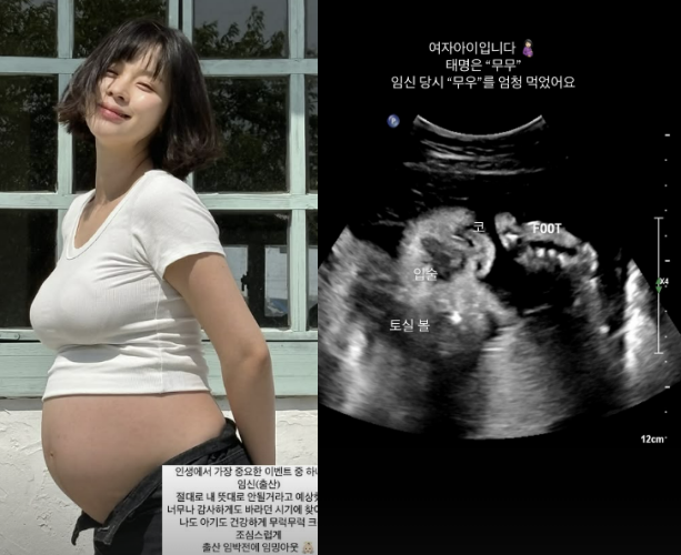  7월 출산 예정, 최윤라 “여자 아이, 태명은 ‘무무’”