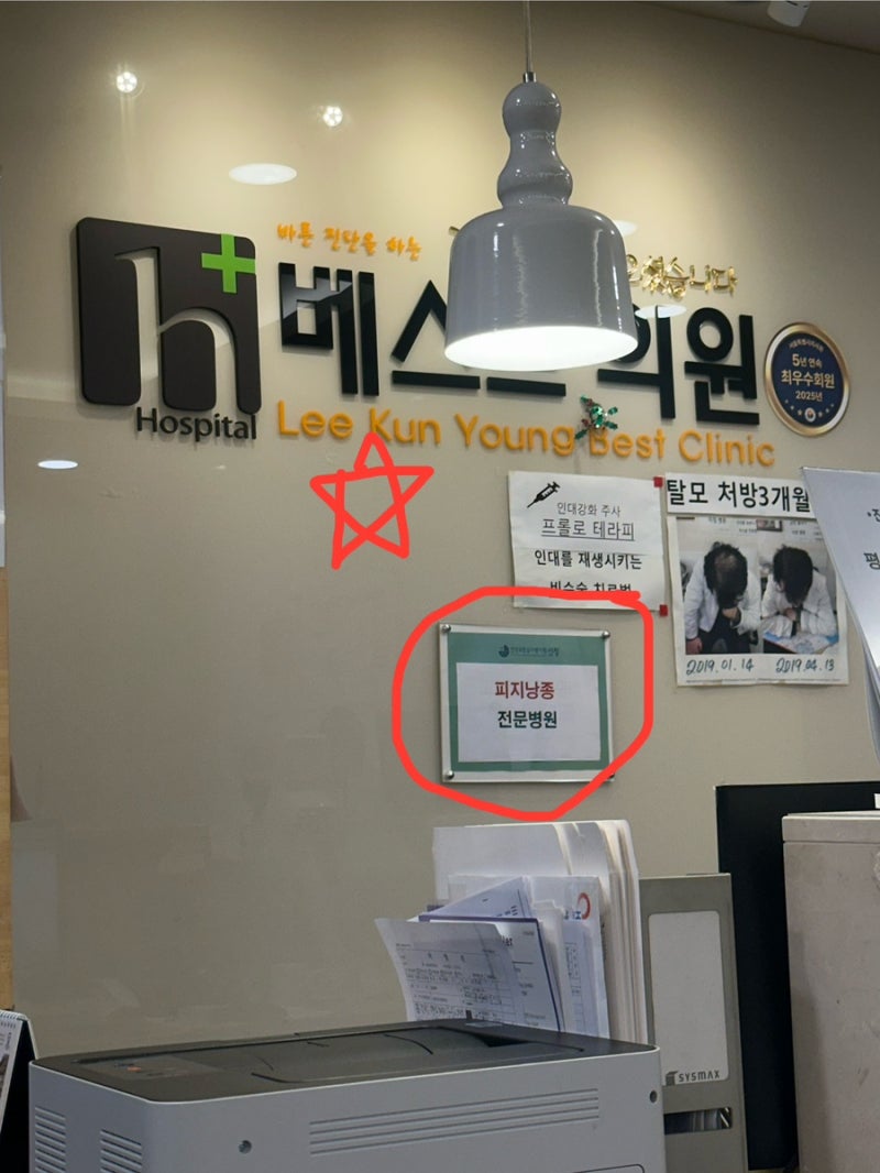 [피지낭종 수술후기] 목 뒤 피지낭종 제거수술 후기(ft. 신림베스트의원)