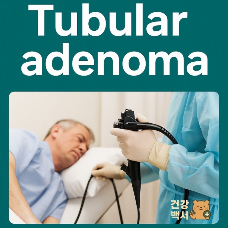  대장내시경 후 Tubular adenoma