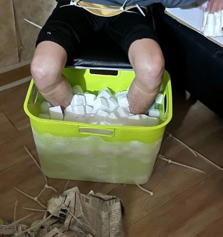 보험금 노리고 드라이아이스에 발 담갔다가 결국… 보험금 노리고 드라이아이스에 발 담갔다가 결국…