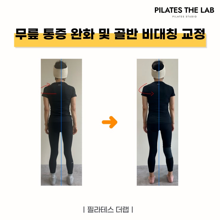  목동필라테스 추천 후기, 53년생 회원의 무릎 통증과 골반 회전 변화 기록