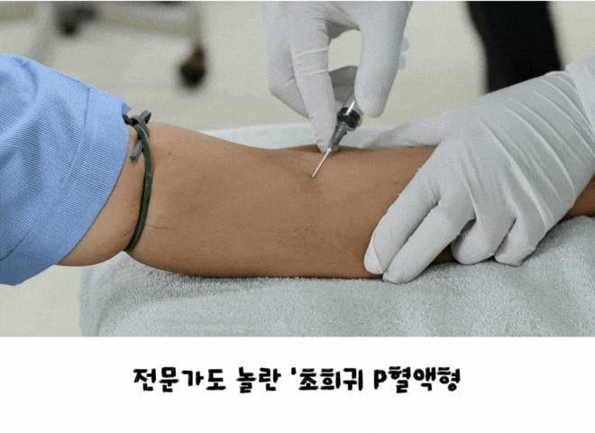  “ p형 혈액형 이 발견됐다!” 100만 분의 1 확률, 가까운 분들 혈액형을 알아보세요.
