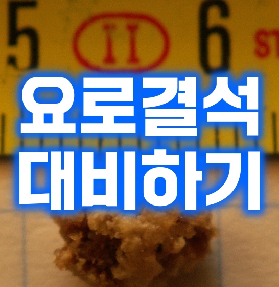  요로결석 허리 통증 위치와 강도 순위부터 증상·원인·치료·음식·예방·수술·체외충격파 제거·비용까지 칼슘 영양제·단백질·스트레스·맥주와의 관계 총정리!