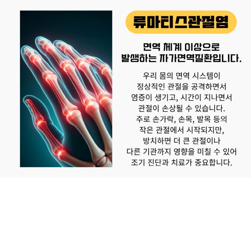 류마티스 관절염 피 검사 안내