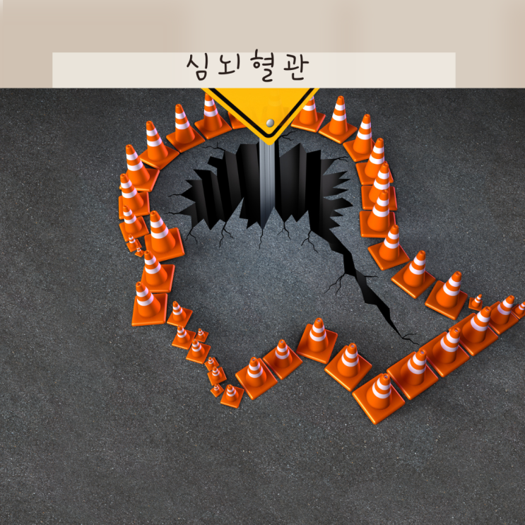 심뇌혈관 나이 위험도 분석! 심뇌혈관 전조 증상 7가지 파악하자