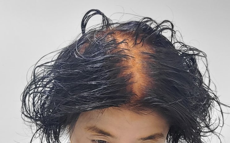  흰머리·탈모엔 워터헤나 인디고! 천연 두피 진정 염색의 모든 것