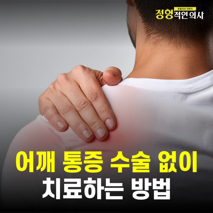  어깨 통증, 석회성 건염의 수술없이 치료하는 법  (정형외과의사작성)