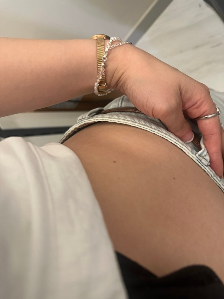 여자 단기간 뱃살빼기 뱃살지방분해주사 무서워서 뱅퀴시 시술받은 후기, 가격, 통증, 효과, 주기 등