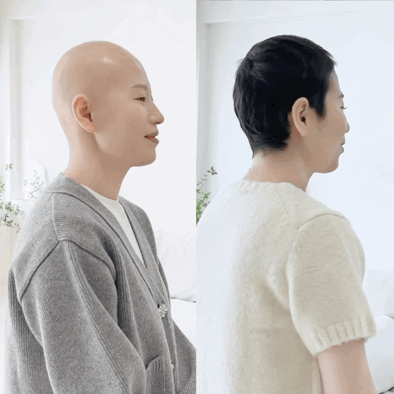 유방암 항암치료 기간에 매일 사용했어요! (탈모 두피를 편안하게 케어하는 암환자 샴푸 & 두....