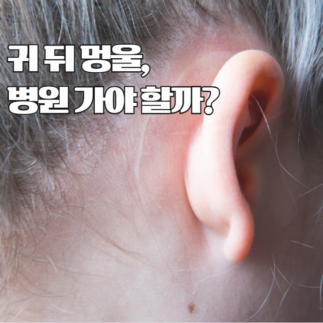 귀뒤에 멍울이 잡힌다면? 걱정해야 할 증상 정리