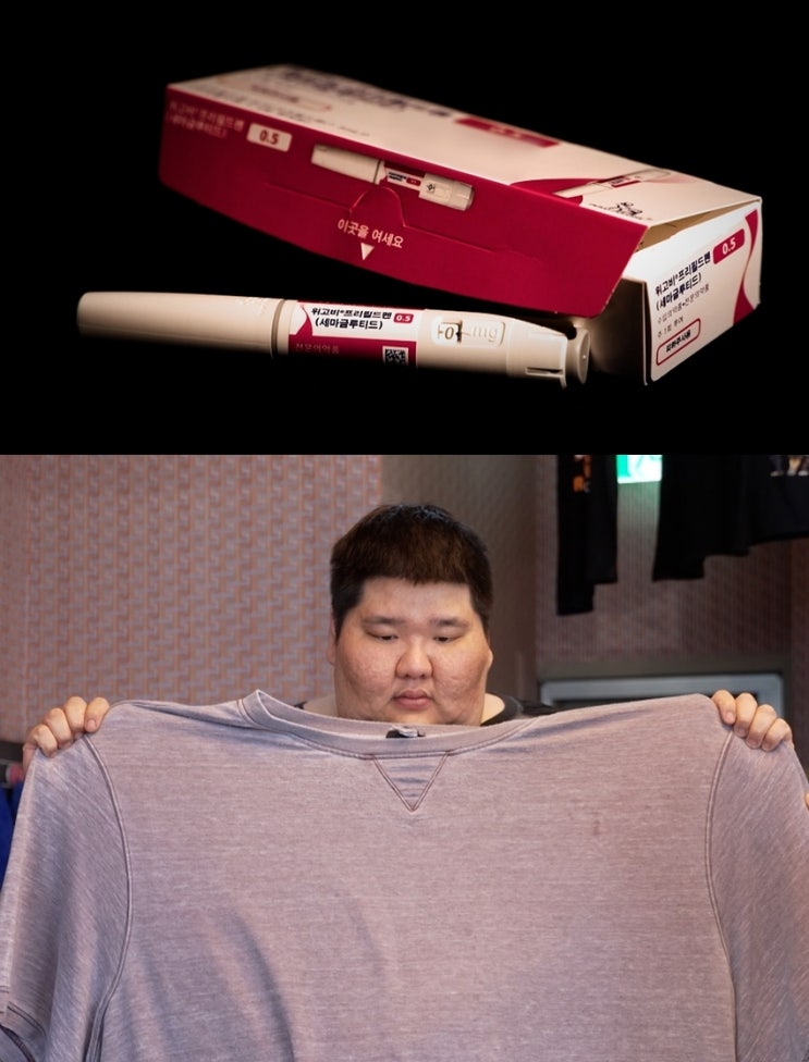 김준호·<b>빠니보틀</b>도 맞은 '<b>위고비</b>'…효과와 <b>부작용</b> 논란 속... 
