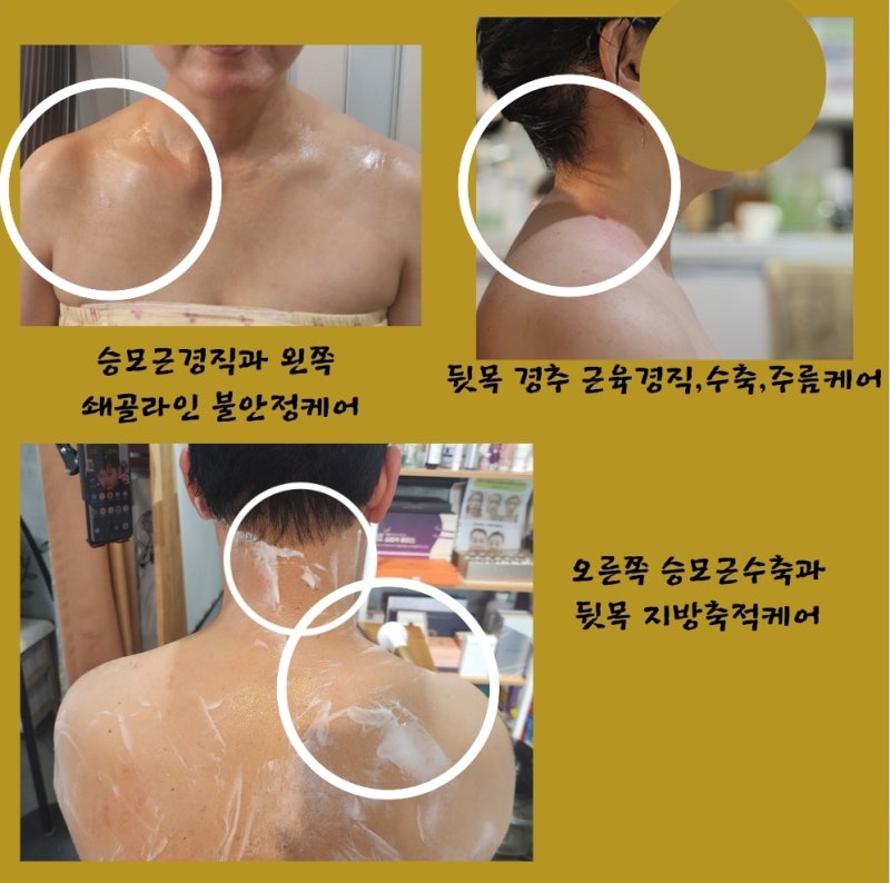 "심부열 고주파로 림프.탄력.피로까지 케어! 닥터올리고 효과 완전 정리"