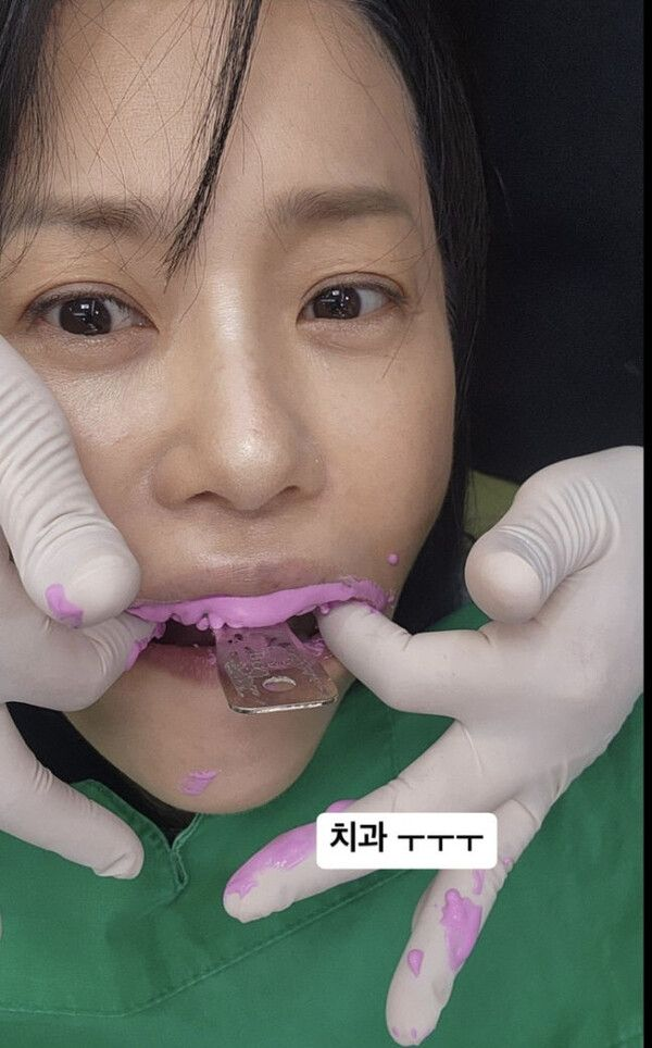  고현정, 치과 굴욕샷?…솔직 매력[핫픽]
