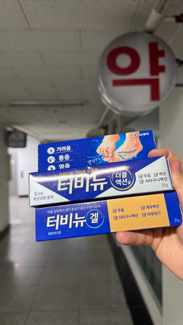  무좀약, 각화형, 지간형 무좀 치료 종류별로 시작해야