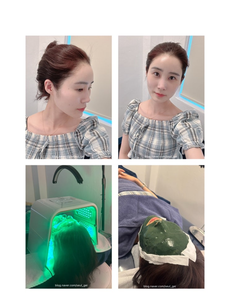 건대피부관리 스킨스튜디오 홍조 관리를 위한 스피루리나