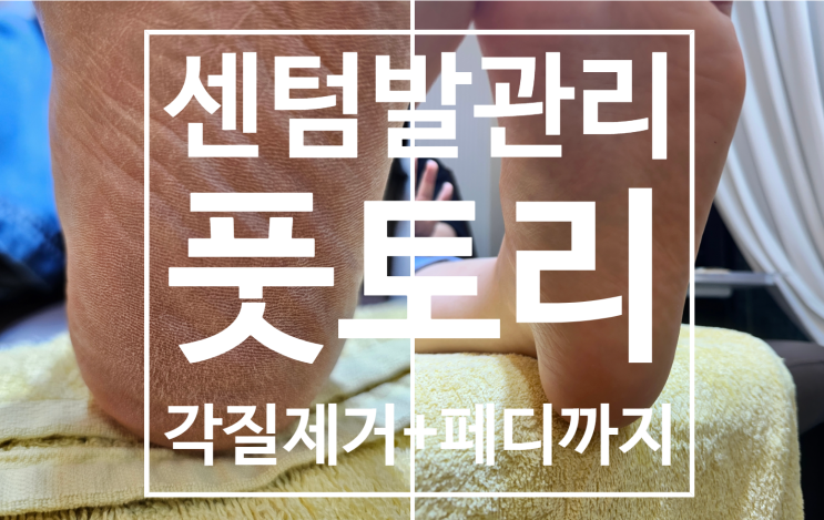 센텀발관리 잘하는 풋토리에서 각질 제거와 페디까지 한번에 한 후기