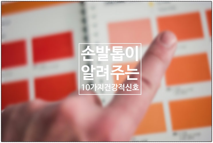  당신의 손(발)톱이 일러주는 10가지 건강 적신호