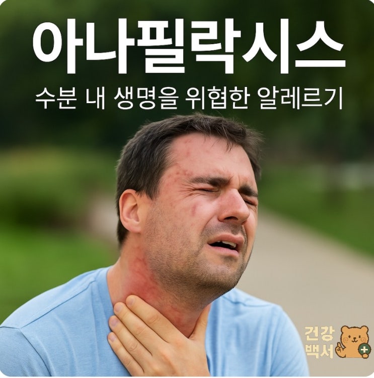  아낙필락시스, 생명을 위협하는 알레르기 반응